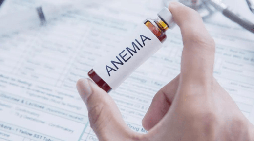 ICD-10 Code for Anemia of Chronic Kidney Disease