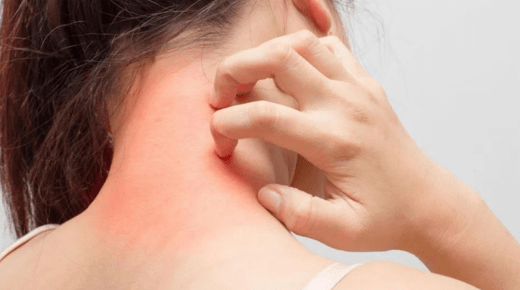 Understanding Allergy and Hypersensitivity – 25 Key Insights