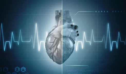 Heart Transplant In Hyderabad