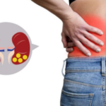 Kidney Stone Treatment In Bangalore