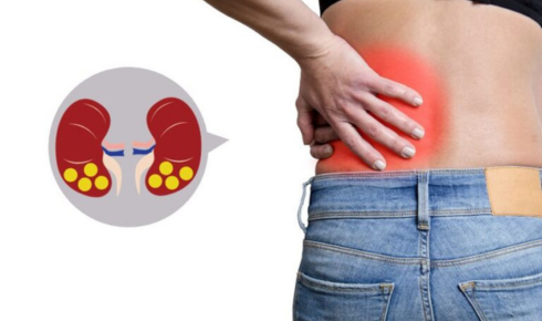 Kidney Stone Treatment In Bangalore
